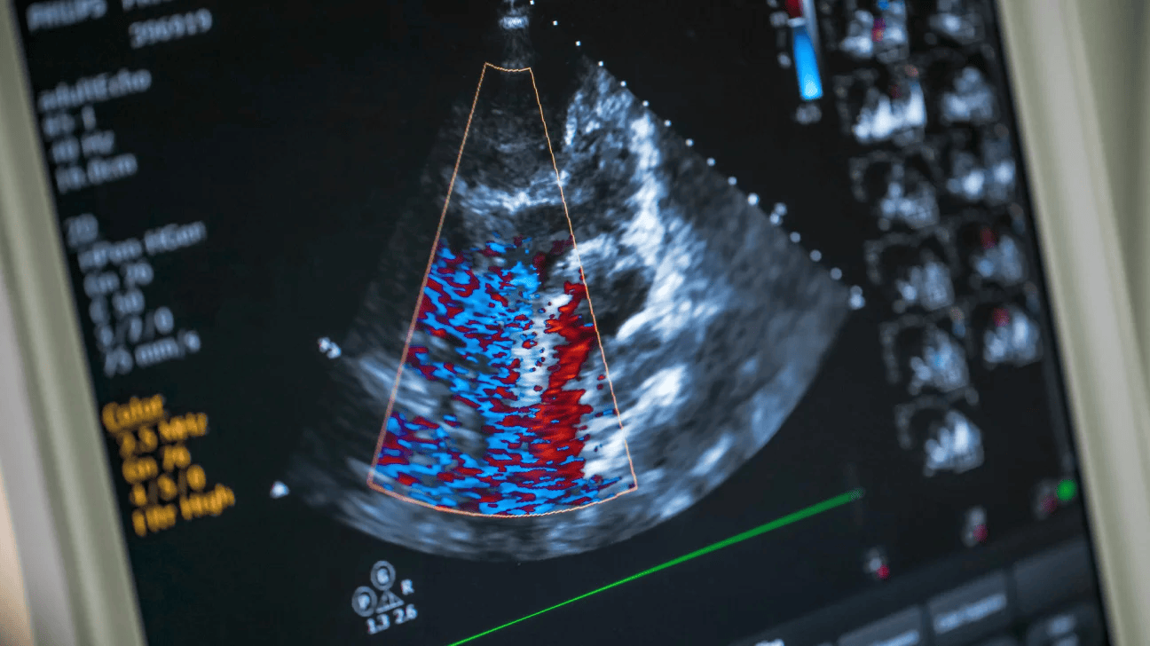 How Much Does an Echocardiogram Cost in 2023?
