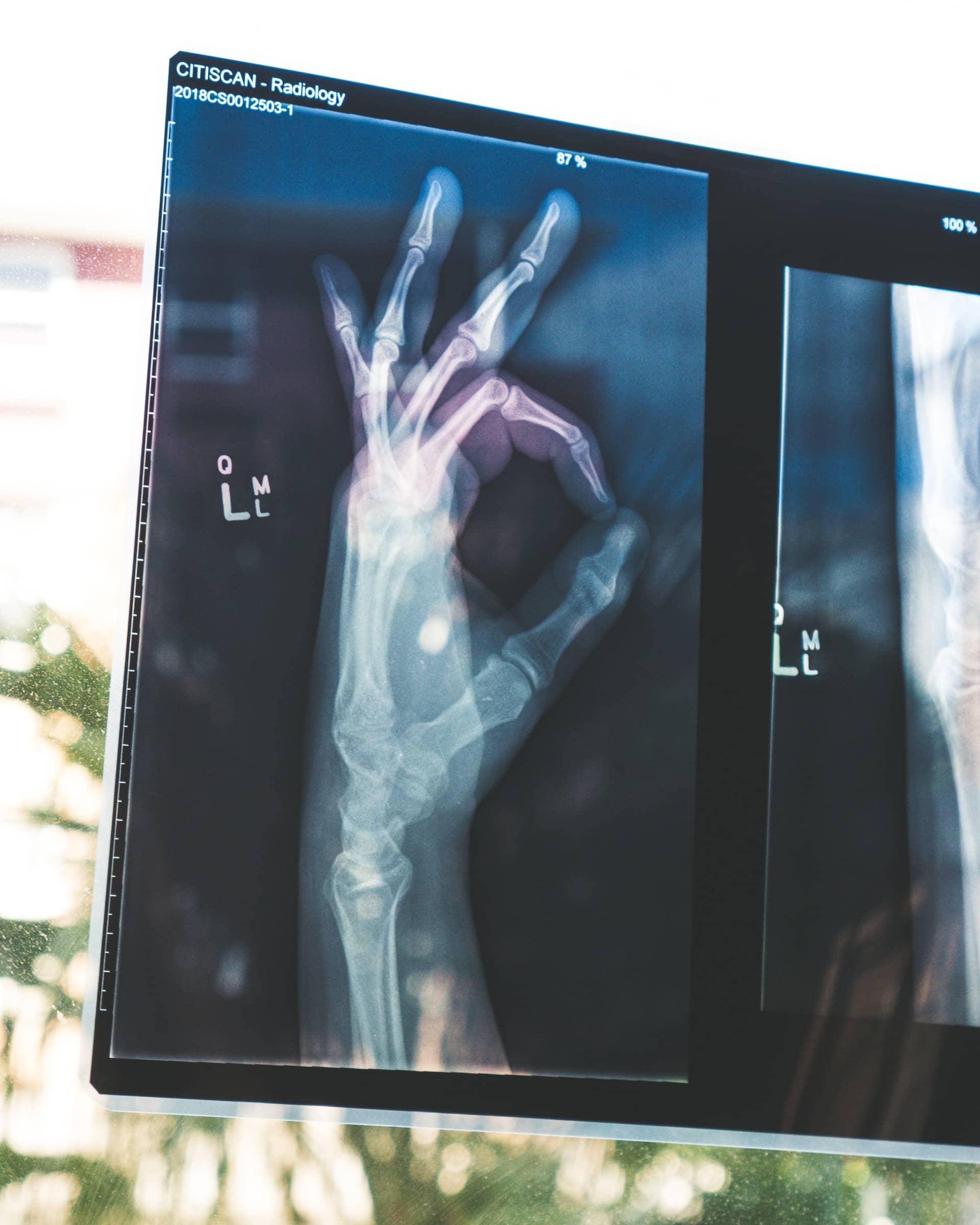 Great tips for Australians requiring private health insurance